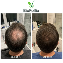 Multi Peptide Hair Growth Serum™